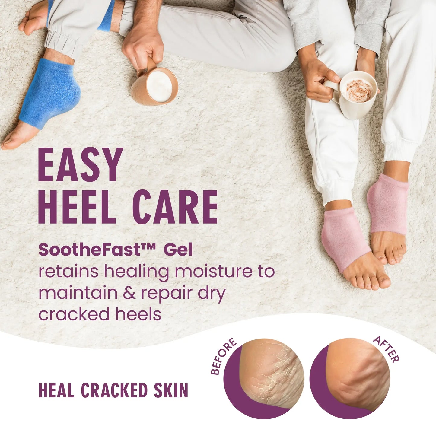 🌙 Overnight Heel Socks – Soften Dry Cracked Feet with Fuzzy Moisturizing Comfort ✿